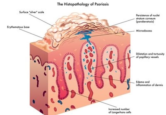 La fototerapia di pigmentary nota su una faccia