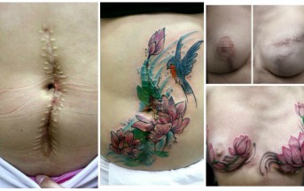 Tatuaggi gratis per coprire i segni della violenza: la moda nasce in Brasile