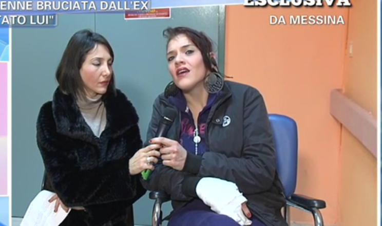 pomeriggio 5 news ragazza bruciata dall fidanzato