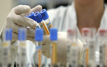 Cancro: test permette di scoprirlo prima che si sviluppi