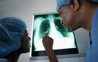 Tumore al polmone: nuova cura d’attacco, immunoterapia in prima linea contro il cancro