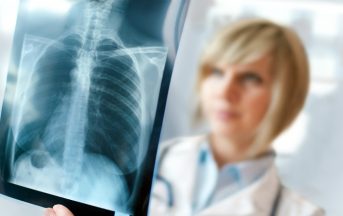 Tumore al polmone: immunoterapia e chemio insieme sono più efficaci contro il cancro