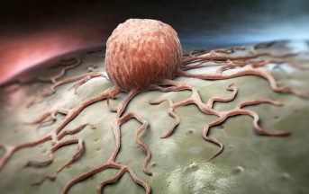 Cancro: scoperto meccanismo che potrebbe bloccarne la proliferazione