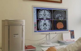 Stimolazione magnetica transcranica per vincere dipendenze e depressione: come funziona?