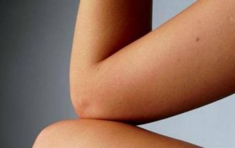 Malattia della pelle lo rende simile a un albero: uomo costretto a vivere in isolamento