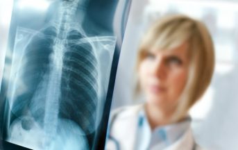 Tumore al polmone: sotto studio lo screening per la diagnosi precoce
