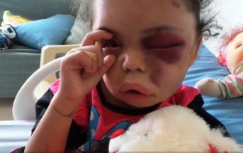 La bambina di 5 anni che ha aperto gli occhi al mondo sulla guerra in Yemen