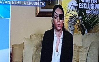 Gessica Notaro sfregiata con l’acido: ex fidanzato condannato a 10 anni di carcere