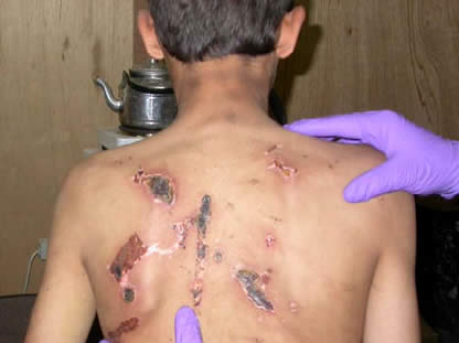 tortura guantanamo