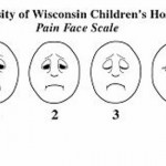 Pain Face Scale