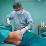 Liposuzione intervento