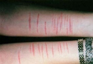 Cutting