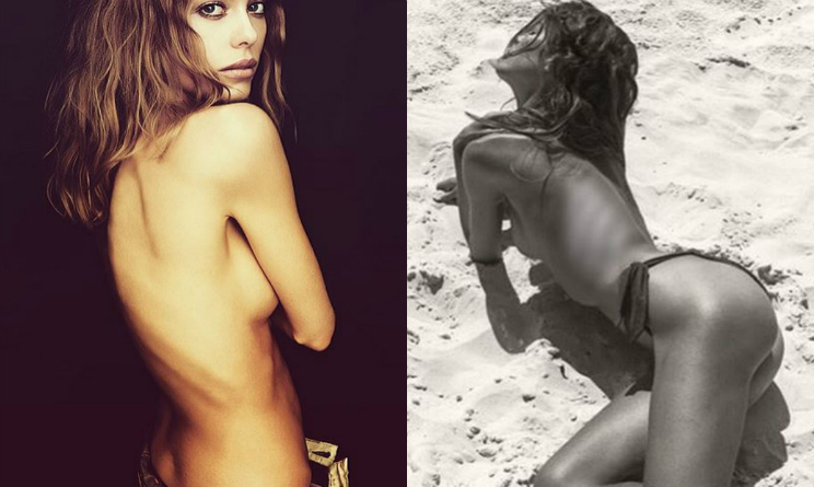 Genevieve Barker, modella anoressica
