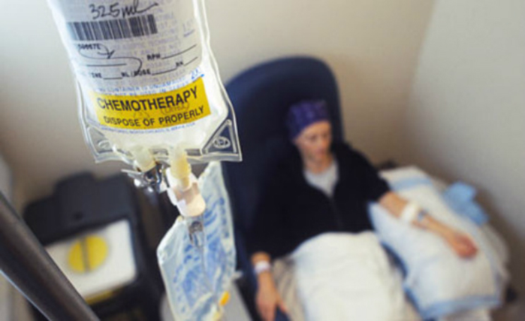 Chemioterapia come funziona e a cosa serve