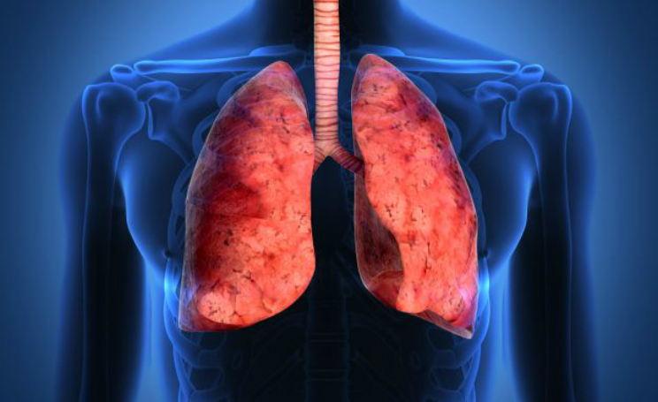 cancro al polmone nuova immunoterapia