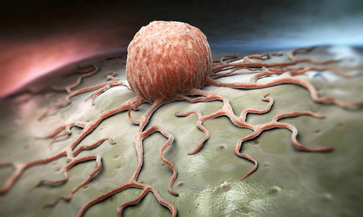 cancro, scoperto meccanismo biologico che potrebbe bloccarne la proliferazione