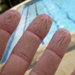 Perché le mani si raggrinziscono in acqua