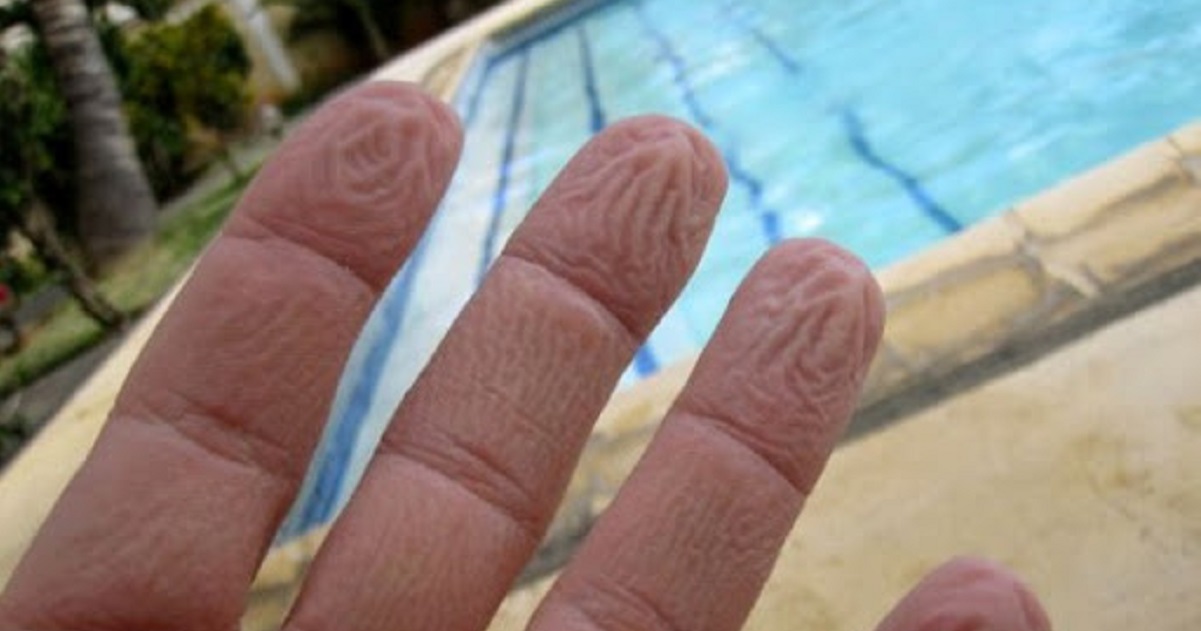 Perché le mani si raggrinziscono in acqua