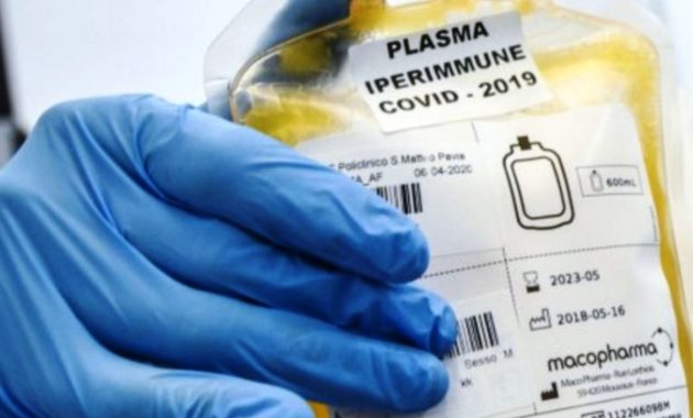 plasma iperimmune