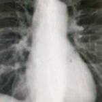 radiografia torace
