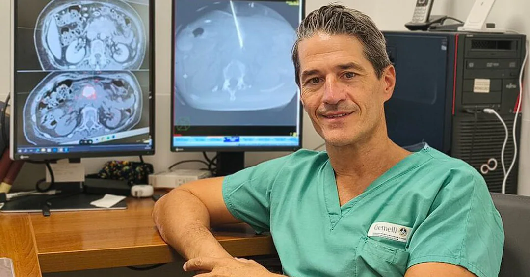 tumore al pancreas primo trattamento al mondo con la colla radioattiva al gemelli la sperimentazione parte da roma da Urbanpost.it tumore al pancreas primo trattamento al mondo con la colla radioattiva al gemelli la sperimentazione parte da roma